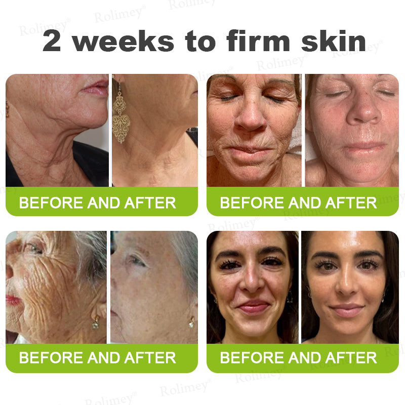 🍭Made and shipped from the USA 💫Rolimey® Botox & Vita-A Retinol Shot Wrinkle-Lift Tightening cream - Last Day Promotion 70% OFF
