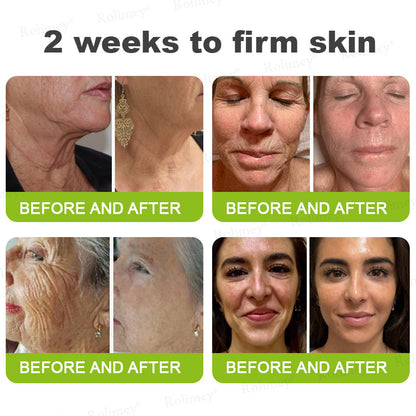 🍭Made and shipped from the USA 💫Rolimey® Botox & Vita-A Retinol Shot Wrinkle-Lift Tightening cream - Last Day Promotion 70% OFF