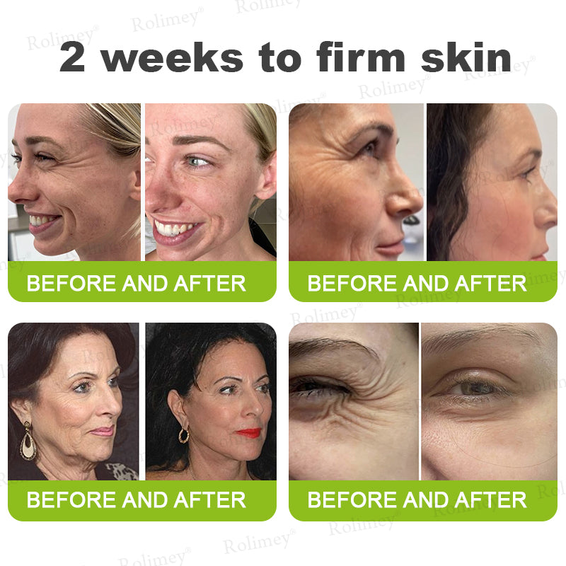 🍭Made and shipped from the USA 💫Rolimey® Botox & Vita-A Retinol Shot Wrinkle-Lift Tightening cream - Last Day Promotion 70% OFF