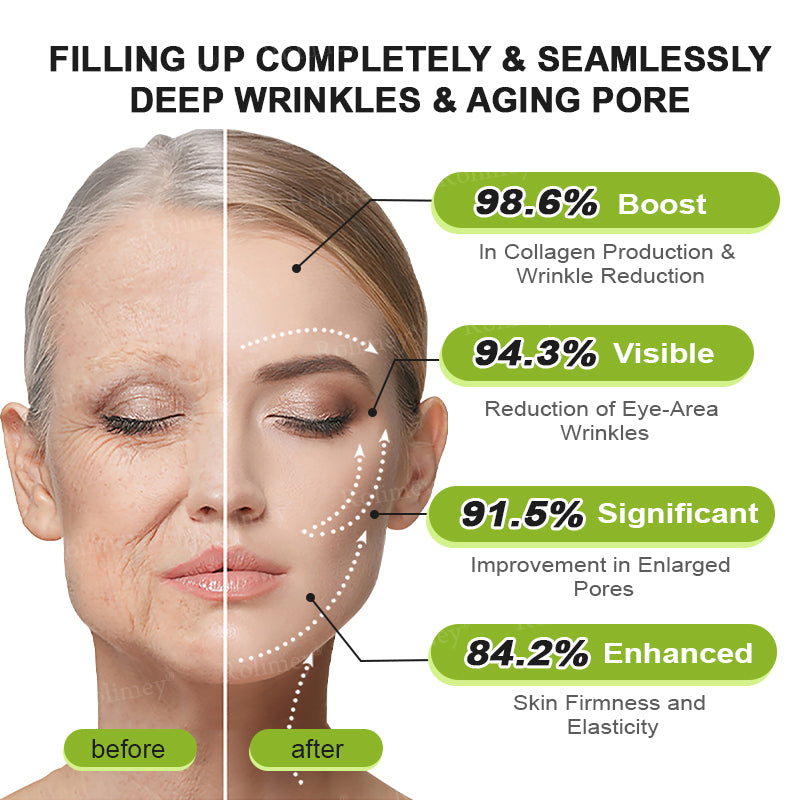 🍭Made and shipped from the USA 💫Rolimey® Botox & Vita-A Retinol Shot Wrinkle-Lift Tightening cream - Last Day Promotion 70% OFF