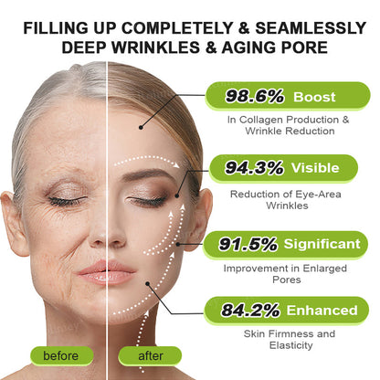 🍭Made and shipped from the USA 💫Rolimey® Botox & Vita-A Retinol Shot Wrinkle-Lift Tightening cream - Last Day Promotion 70% OFF