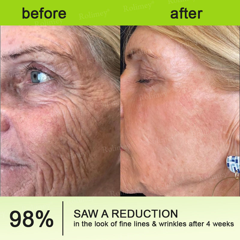 🍭Made and shipped from the USA 💫Rolimey® Botox & Vita-A Retinol Shot Wrinkle-Lift Tightening cream - Last Day Promotion 70% OFF