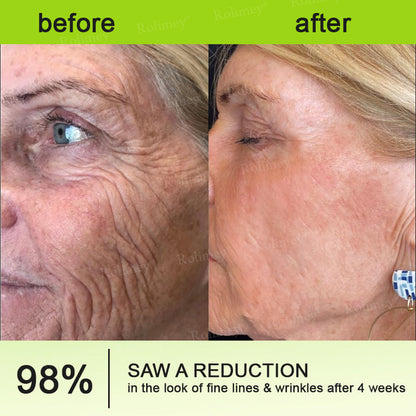 🍭Made and shipped from the USA 💫Rolimey® Botox & Vita-A Retinol Shot Wrinkle-Lift Tightening cream - Last Day Promotion 70% OFF