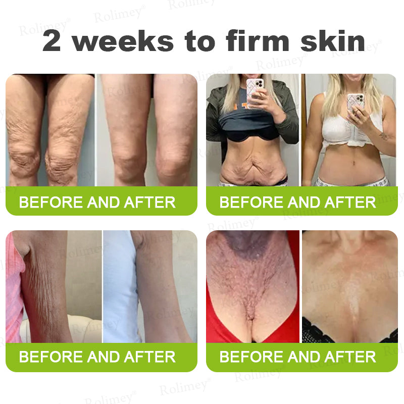 🍭Made and shipped from the USA 💫Rolimey® Botox & Vita-A Retinol Shot Wrinkle-Lift Tightening cream - Last Day Promotion 70% OFF