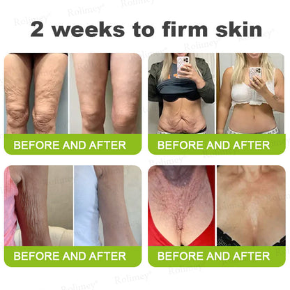 🍭Made and shipped from the USA 💫Rolimey® Botox & Vita-A Retinol Shot Wrinkle-Lift Tightening cream - Last Day Promotion 70% OFF