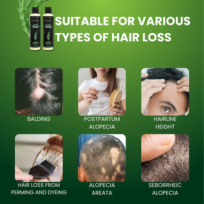 🔥 Final Hours! Save 78% on LONLDS® Rosemary Keratin Shampoo – Limited Stock: Only 58 Bottles Left!