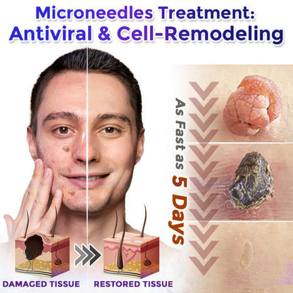 🧙‍♂️Celsiora® Multi-Functional Microneedle Hydrocolloid Patch Roll | Targets Skin Tags, Warts & Stubborn Blemishes